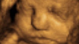 Pregled u trećem tromjesečju trudnoće Pregled u trećem tromjesečju trudnoće