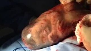 Bebino oslobađanje iz amnionske vreće i njen prvi udah zabilježeni kamerom! Bebino oslobađanje iz amnionske vreće i njen prvi udah zabilježeni kamerom!
