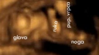 Privatno rodilište - odluka Privatno rodilište - odluka