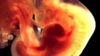 Prenatalni razvoj - 1. tromjesečje Prenatalni razvoj - 1. tromjesečje