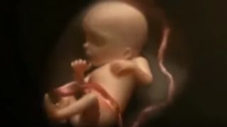 Video: Razvoj bebe u trudnoći Video: Razvoj bebe u trudnoći